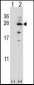 IL17B Antibody (Center)